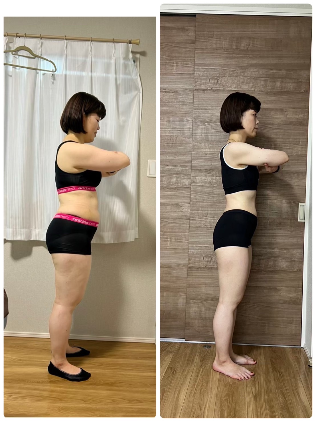 ビフォー 43歳女性