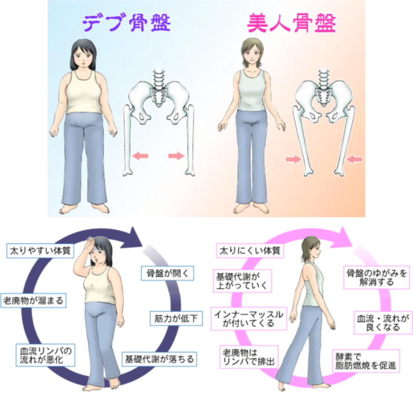 デブ骨盤・美人骨盤