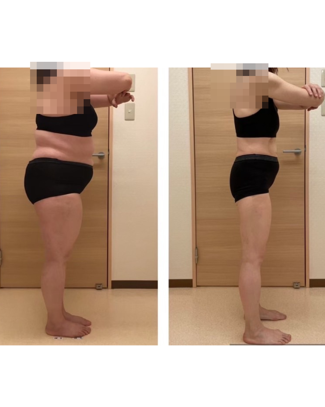 40代後半・-30kgの側面ビフォーアフター（顔はモザイク処理）