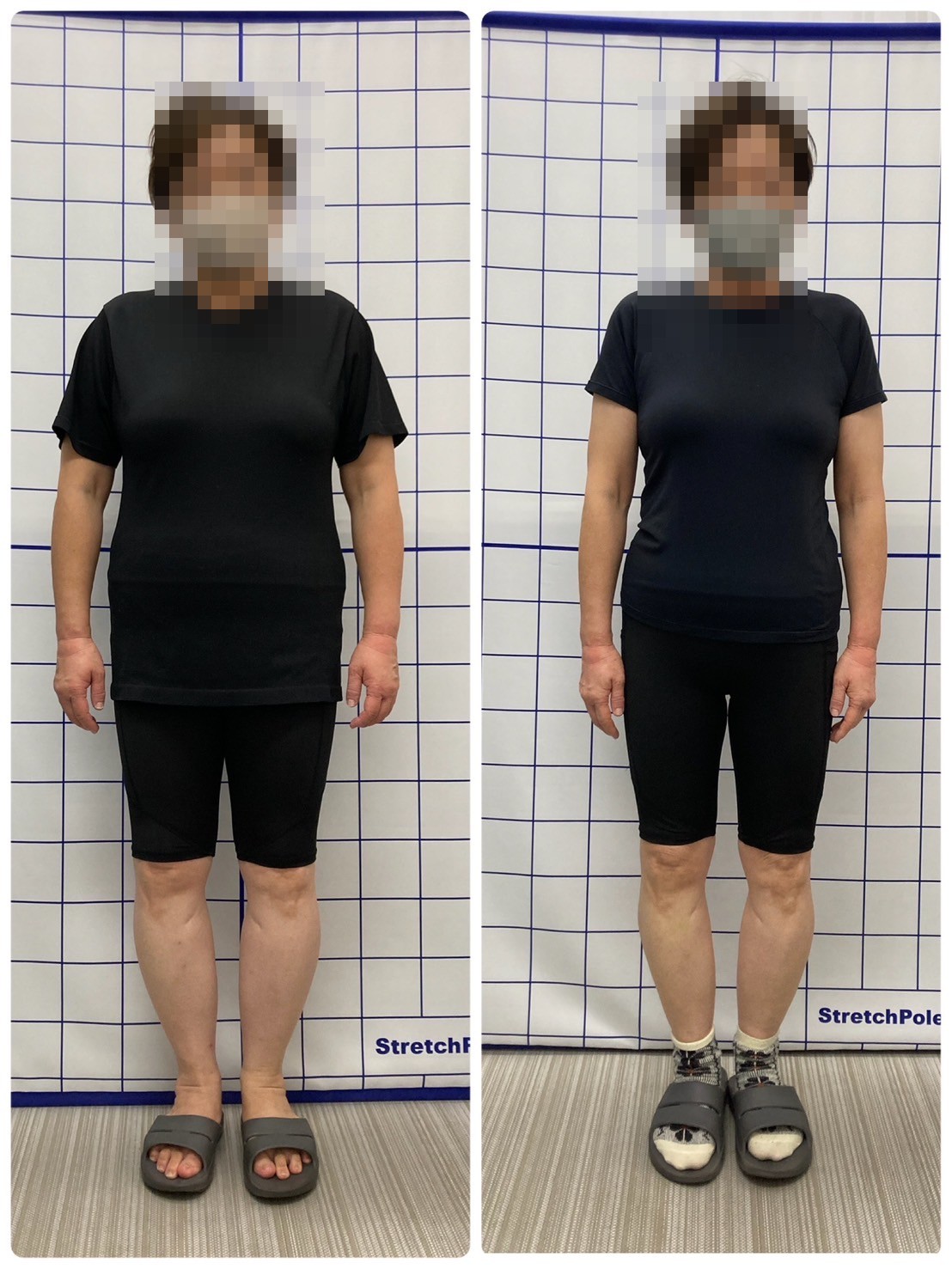 48歳・4ヶ月で-14kgの着衣ビフォーアフター（顔はモザイク処理）